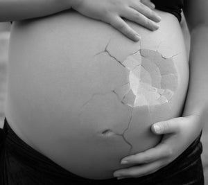 The Heartache of Pre-Natal Passing